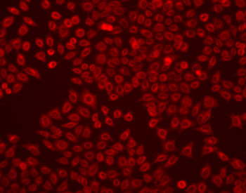 Staining of live HeLa cells using LavaCell
