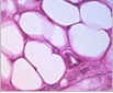Adipose Tissue