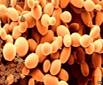Yeast Cells