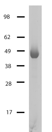 HDAC4 Coomassie gel.