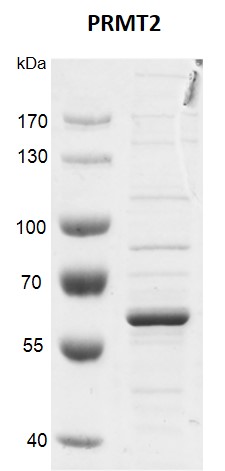 Recombinant PRMT2 protein gel.