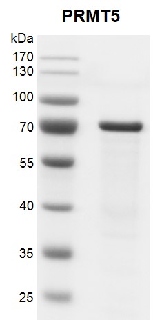 Recombinant PRMT5 protein gel.