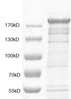PRDM10 Coomassie gel