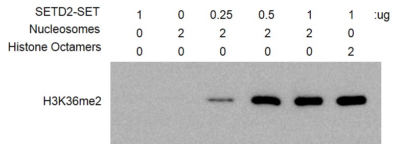 HMT Assay for Recombinant SETD2 (1392-2564) protein activity.