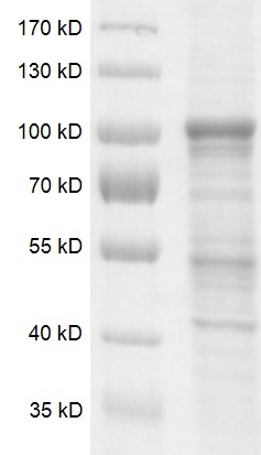 DNMT3B protein Coomassie gel