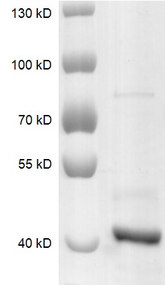 SETD8 protein Coomassie gel