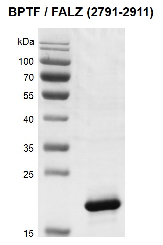Recombinant BPTF / FALZ (2791-2911) protein gel.