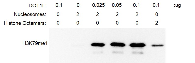 Recombinant DOT1L (1-416) protein activity assay.