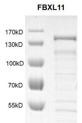 KDM2A / FBXL11 protein Coomassie gel