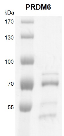 PRDM6 protein Coomassie gel