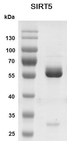 Recombinant SIRT5 SDS-PAGE gel.