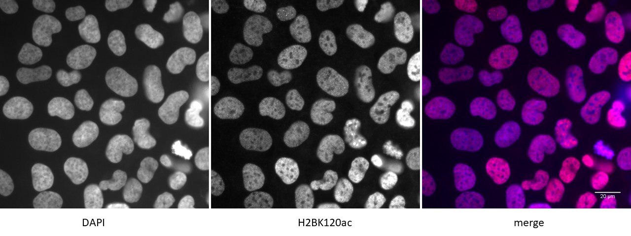 Histone H2BK120ac antibody (pAb) tested by immunofluorescence.