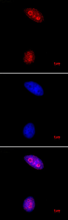 Histone H3K27me3 antibody (pAb) tested by immunofluorescence.