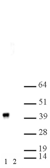 MEP50 antibody (pAb) tested by Western blot.