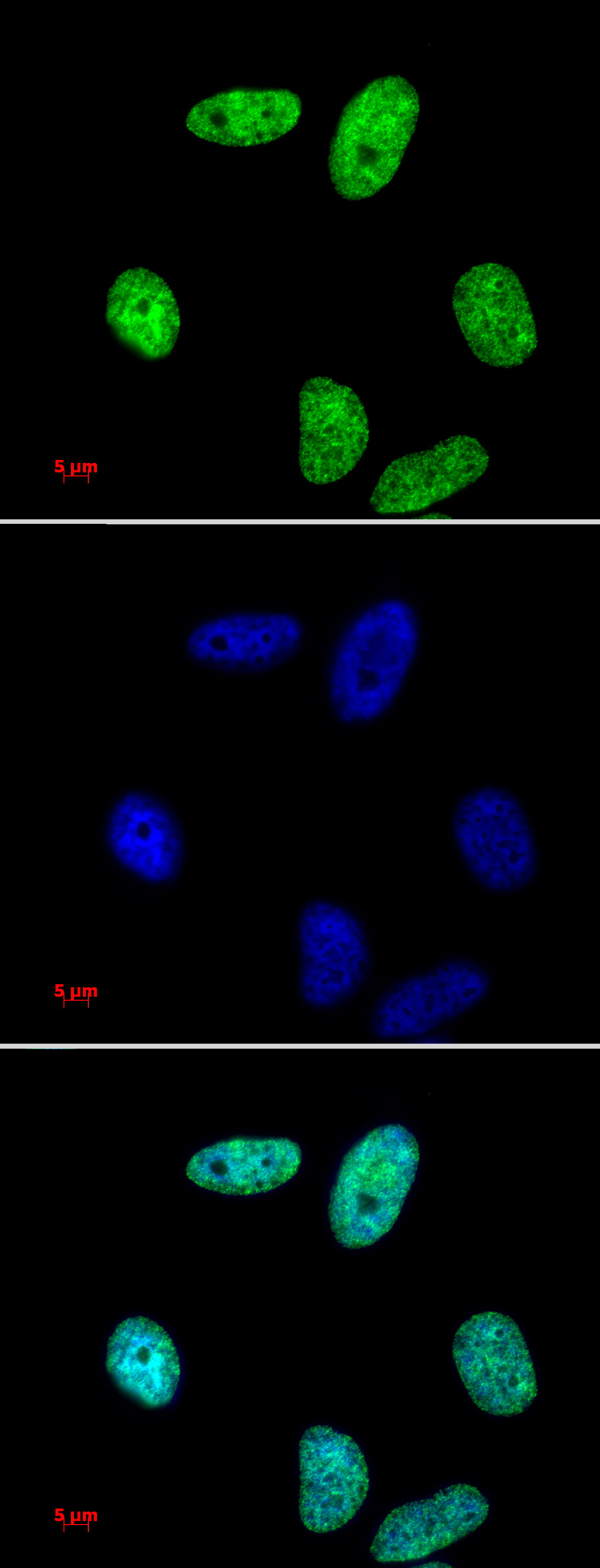 Histone H3K27me2 antibody (pAb) tested by immunofluorescence.