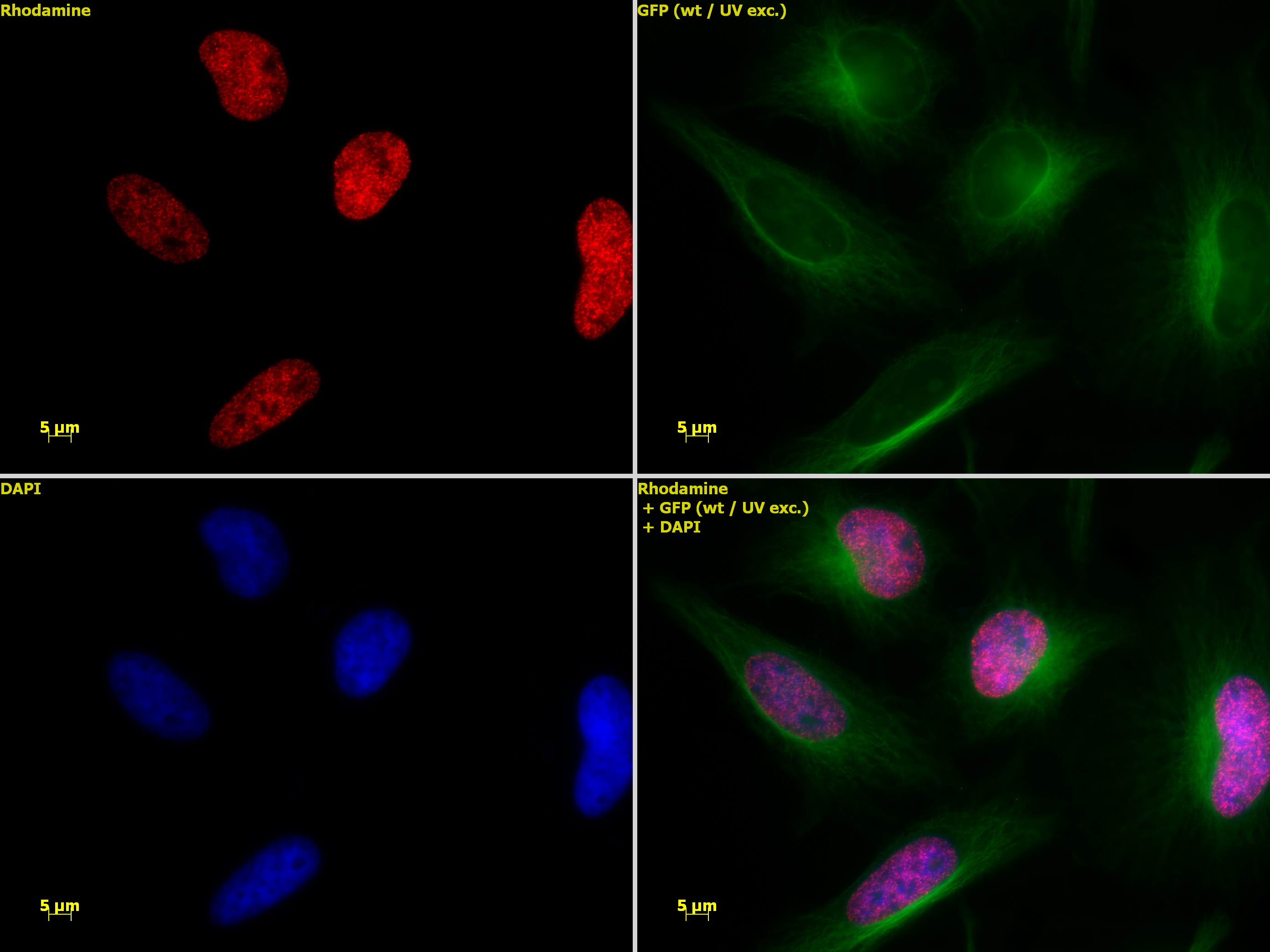 Histone H3K36ac antibody (pAb) tested by immunofluorescence.