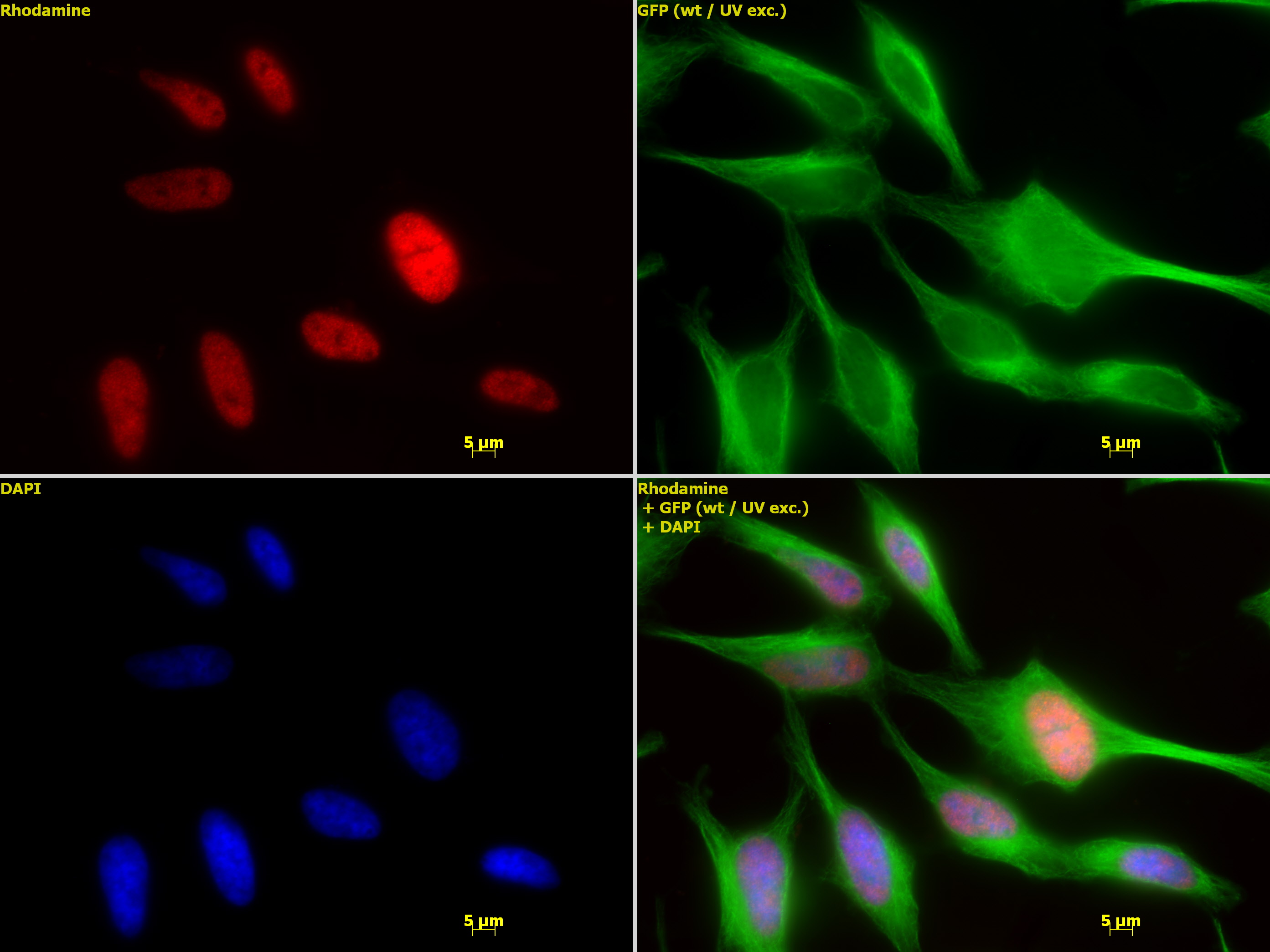 Anti-Brn-3a Antibody, POU-domain protein, clone 5A3.2 culture supernatant,  clone 5A3.2, Chemicon®