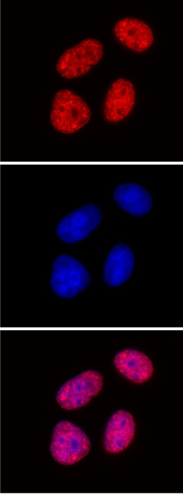 Histone H3K27me2me3 antibody (mAb) tested by immunofluorescence.