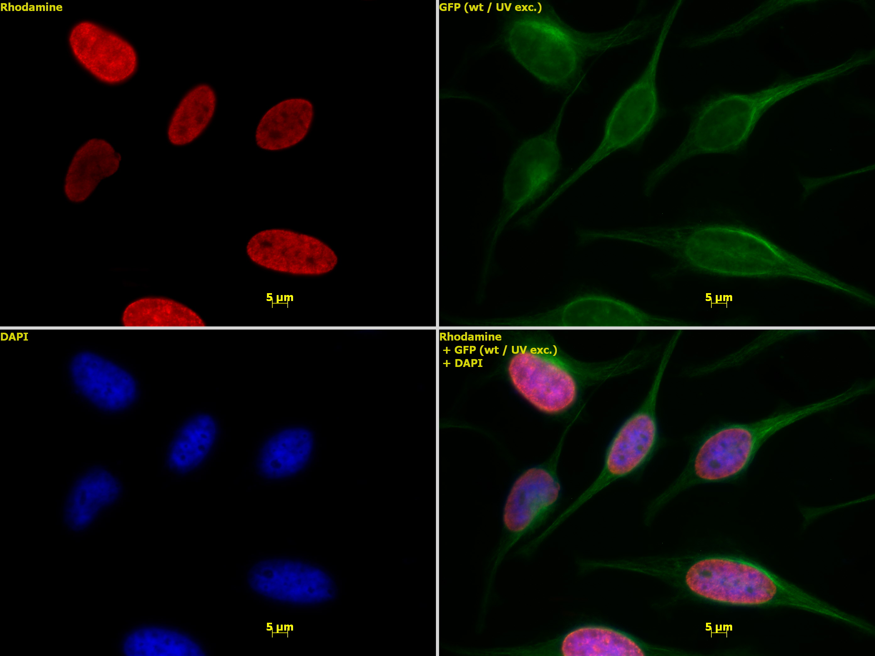 Histone H4K5ac antibody (pAb) tested by immunofluorescence.