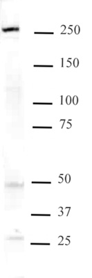 Mi-2 beta antibody (mAb) tested by Western blot.