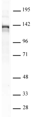 PHF8 antibody (pAb) tested by Western blot.