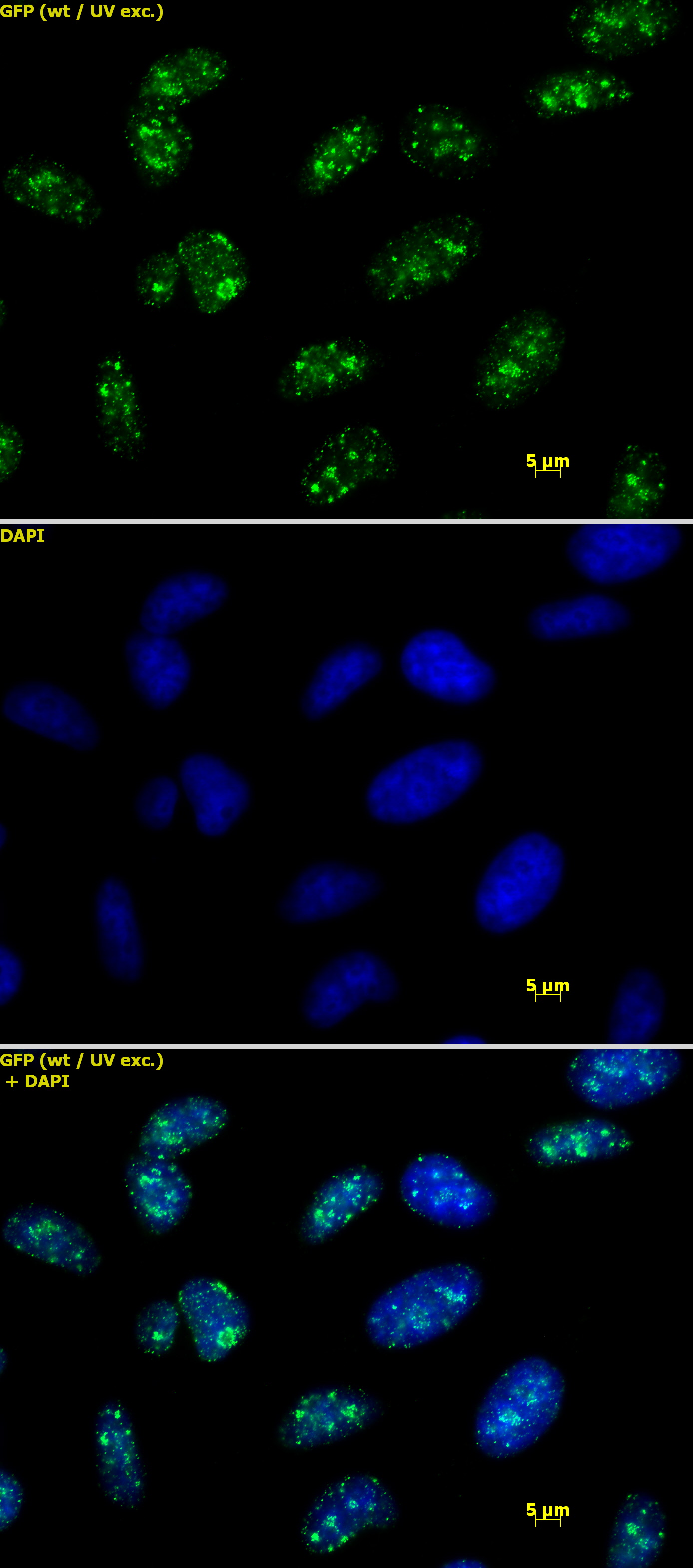 Histone H3K9me3 antibody (pAb) tested by immunofluorescence.