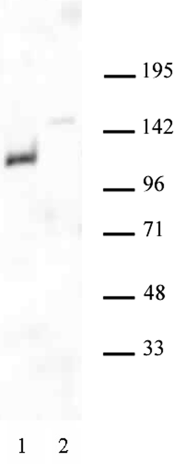 Androgen Receptor antibody (pAb) tested by Western blot.