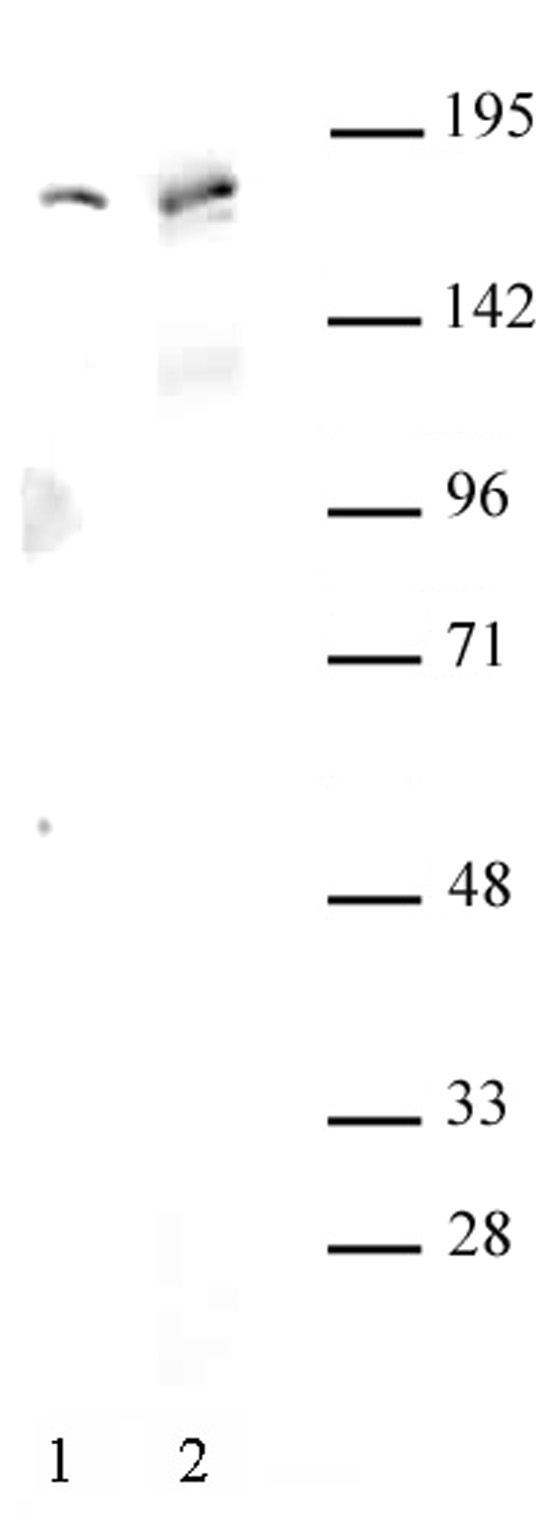 AIB1 / SRC-3 antibody (pAb) tested by Western blot.