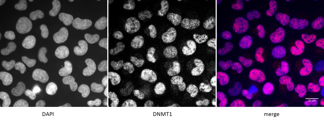 DNMT1 antibody (pAb) tested by immunofluorescence.