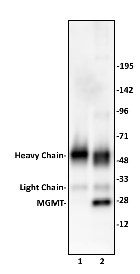 MGMT antibody (pAb) tested by immunoprecipitation.