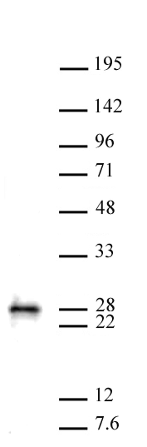MGMT antibody (pAb) tested by Western blot.