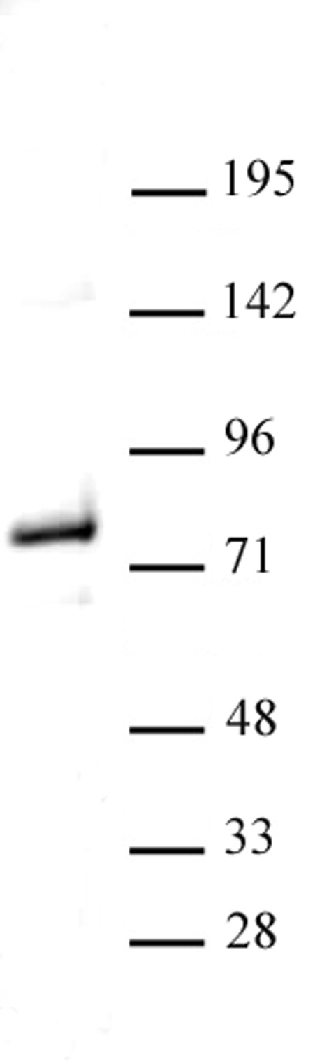 Menin antibody (pAb) tested by Western blot.