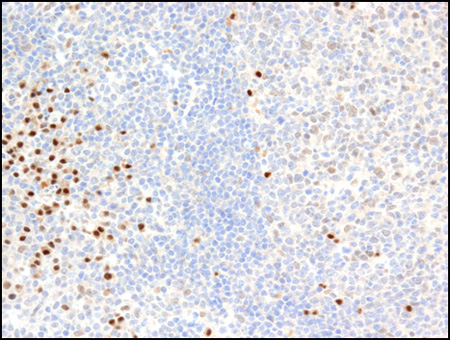 PIM2 antibody (mAb) tested by immunohistochemistry.