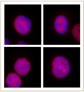 JMJD2B / KDM4B antibody (pAb) tested by immunofluorescence.