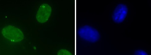 DHX9 antibody (mAb) tested by immunofluorescence.