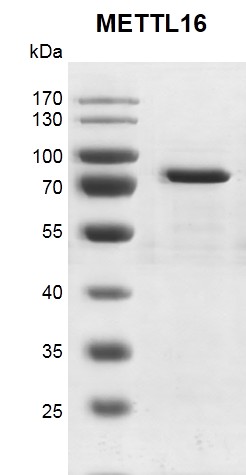 Recombinant METTL16 protein gel