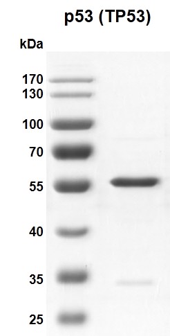 Recombinant p53 (TP53) protein gel
