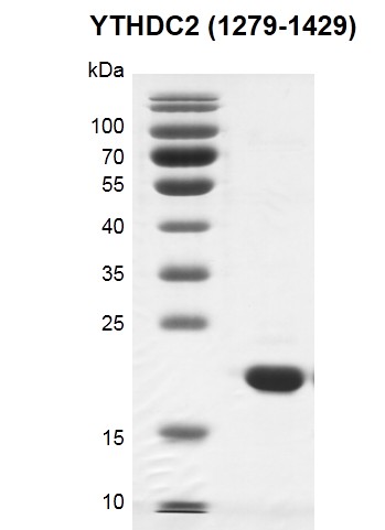 Recombinant YTHDC2 (1279-1429) SDS PAGE gel