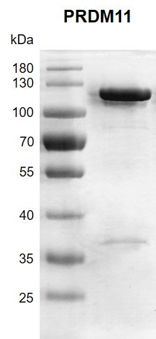 Recombinant PRDM11 protein gel