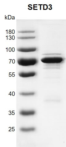 Recombinant SETD3 protein gel