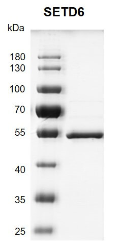 Recombinant SETD6 protein gel