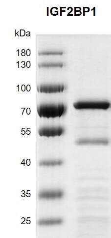 Recombinant IGF2BP1 protein gel