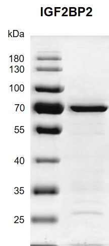 Recombinant IGF2BP2 protein gel