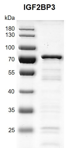 Recombinant IGF2BP3 protein gel