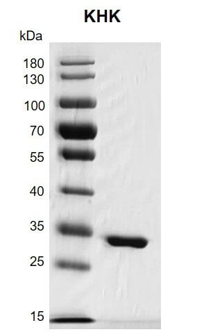 Recombinant Ketohexokinase protein gel