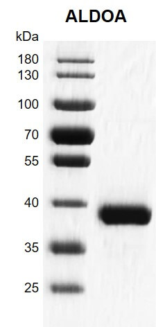>Recombinant ALDOA protein gel