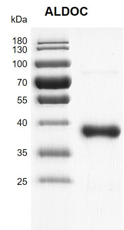 Recombinant ALDOC protein gel
