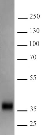 Recombinant SARS-CoV-2 Spike protein, S1 (aa319-541) protein gel.