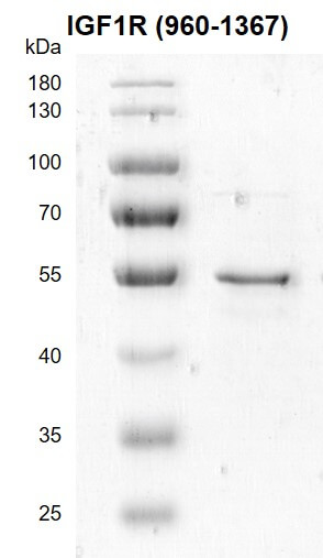 Recombinant IGF1R (960-1367) protein