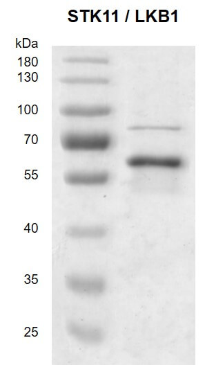 Recombinant STK11 / LKB1 protein